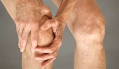 Control arthritis